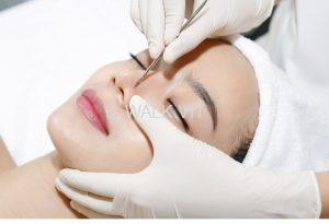 spa trị mụn Phan Rang hiệu quả an toàn nhất